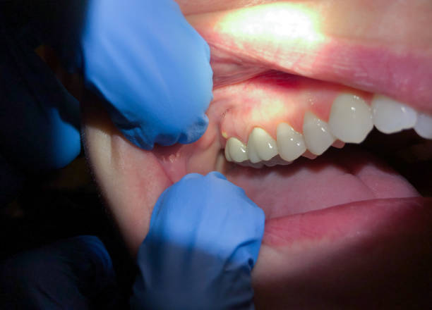 Best Orthodontic Emergency Dentist in Stiles, PA
