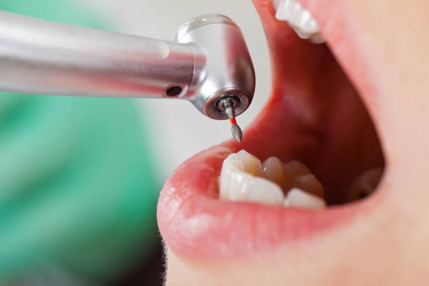 Best Emergency Dentist for Knocked-Out Tooth in Stiles, PA